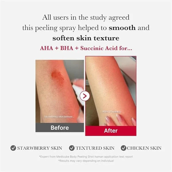 Medicube Red Acne Body Peeling Shot