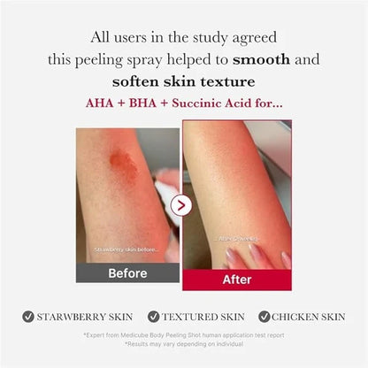 Medicube Red Acne Body Peeling Shot