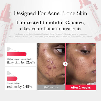 Medicube Hypochlorous Acid Daily Facial Spray