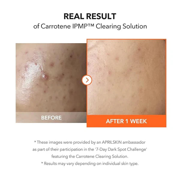 APRILSKIN Carrotene IPMP™ Clearing Solution 20ml 2