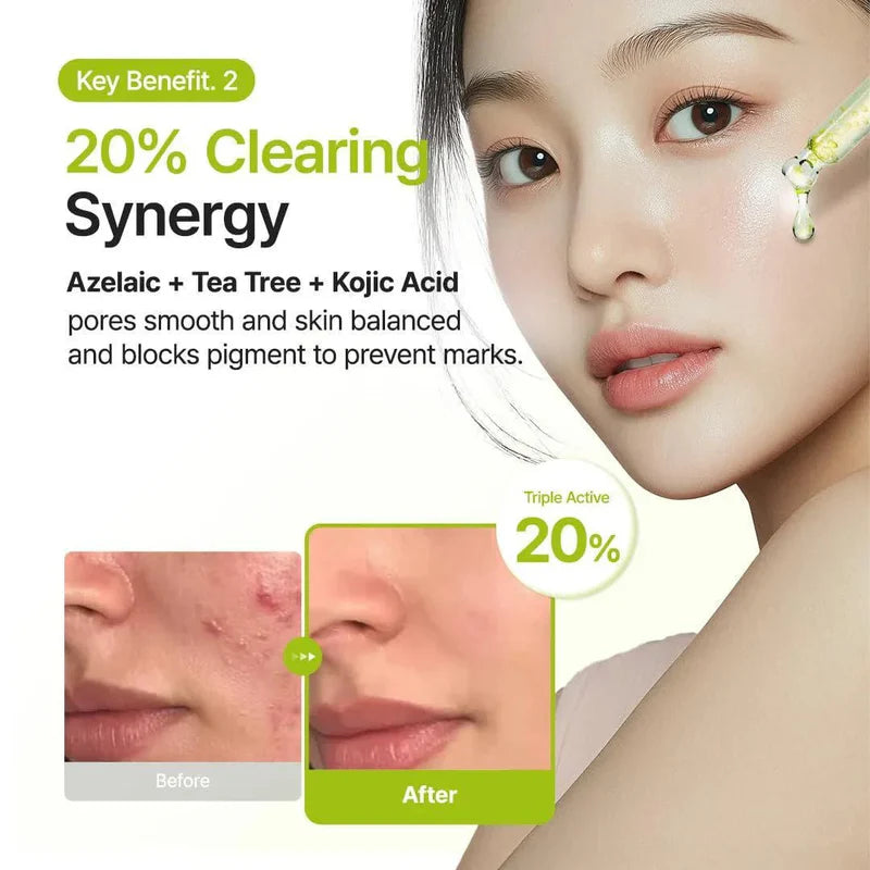 Purito Azelaic Acid 10 % + Kojic & Tea Tree Serum – 30 ml 2