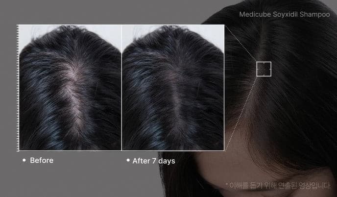 Medicube Soyxidil Shampoo